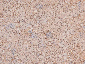 Anti-NAK / TBK1 (phospho Ser172) antibody used in IHC (Paraffin sections) (IHC-P). GTX02815