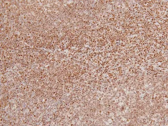 Anti-NAK / TBK1 (phospho Ser172) antibody used in IHC (Paraffin sections) (IHC-P). GTX02815