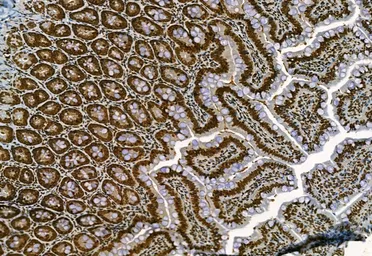 Anti-NAK / TBK1 (phospho Ser172) antibody used in IHC (Paraffin sections) (IHC-P). GTX02815
