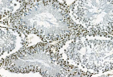 Anti-NAK / TBK1 (phospho Ser172) antibody used in IHC (Paraffin sections) (IHC-P). GTX02815