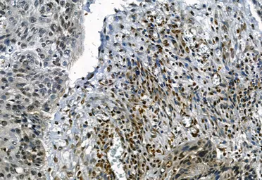 Anti-NAK / TBK1 (phospho Ser172) antibody used in IHC (Paraffin sections) (IHC-P). GTX02815