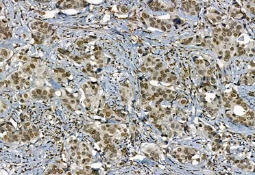 Anti-NAK / TBK1 (phospho Ser172) antibody used in IHC (Paraffin sections) (IHC-P). GTX02815