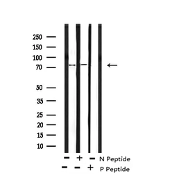 Anti-NAK / TBK1 (phospho Ser172) antibody used in Western Blot (WB). GTX02815