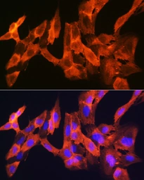 Anti-JNK1 + JNK3 antibody [GT1227] used in Immunocytochemistry/ Immunofluorescence (ICC/IF). GTX02824