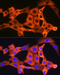 Anti-JNK1 + JNK3 antibody [GT1227] used in Immunocytochemistry/ Immunofluorescence (ICC/IF). GTX02824