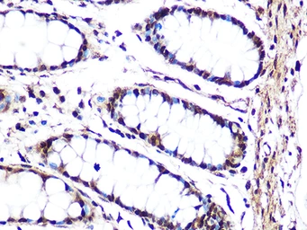 Anti-JNK1 + JNK3 antibody [GT1227] used in IHC (Paraffin sections) (IHC-P). GTX02824