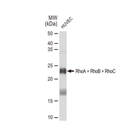 Anti-RhoA + RhoB + RhoC antibody [GT1228] used in Western Blot (WB). GTX02825