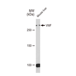 Anti-VWF antibody [GT1230] used in Western Blot (WB). GTX02827