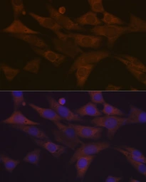 Anti-PKC delta antibody [GT1232] used in Immunocytochemistry/ Immunofluorescence (ICC/IF). GTX02829