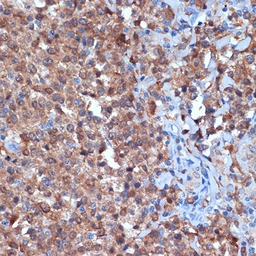 Anti-PKC delta antibody [GT1232] used in IHC (Paraffin sections) (IHC-P). GTX02829