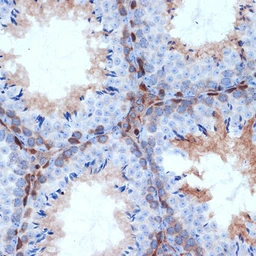 Anti-PKC delta antibody [GT1232] used in IHC (Paraffin sections) (IHC-P). GTX02829