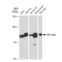Anti-PKC delta antibody [GT1232] used in Western Blot (WB). GTX02829