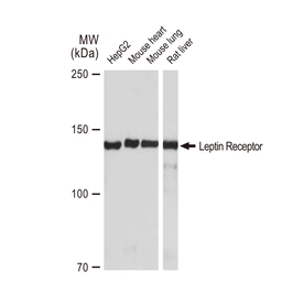 Anti-Leptin Receptor antibody [GT1233] used in Western Blot (WB). GTX02830