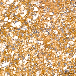 Anti-Leptin Receptor antibody [GT1233] used in IHC (Paraffin sections) (IHC-P). GTX02830