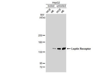 Anti-Leptin Receptor antibody [GT1233] used in Western Blot (WB). GTX02830
