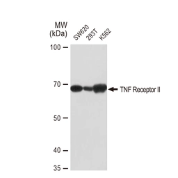 Anti-TNF Receptor II antibody [GT1237] used in Western Blot (WB). GTX02834