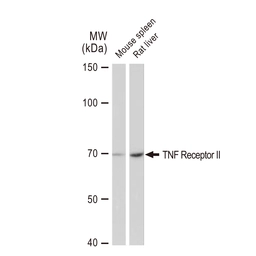 Anti-TNF Receptor II antibody [GT1237] used in Western Blot (WB). GTX02834