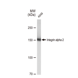 Anti-Integrin alpha 2 antibody [GT1238] used in Western Blot (WB). GTX02835