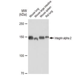 Anti-Integrin alpha 2 antibody [GT1238] used in Western Blot (WB). GTX02835