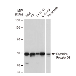 Anti-Dopamine Receptor D3 antibody [GT1239] used in Western Blot (WB). GTX02836