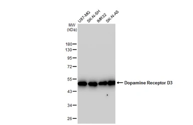 Anti-Dopamine Receptor D3 antibody [GT1239] used in Western Blot (WB). GTX02836