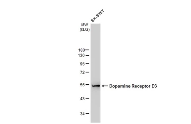 Anti-Dopamine Receptor D3 antibody [GT1239] used in Western Blot (WB). GTX02836