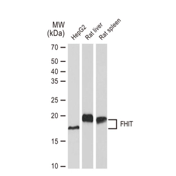 Anti-FHIT antibody [GT1240] used in Western Blot (WB). GTX02837