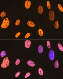 Anti-hnRNP U antibody [GT1242] used in Immunocytochemistry/ Immunofluorescence (ICC/IF). GTX02839