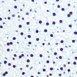 Anti-hnRNP U antibody [GT1242] used in IHC (Paraffin sections) (IHC-P). GTX02839
