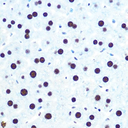Anti-hnRNP U antibody [GT1242] used in IHC (Paraffin sections) (IHC-P). GTX02839