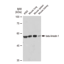 Anti-beta Arrestin 1 antibody [GT1243] used in Western Blot (WB). GTX02840