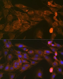 Anti-STAT4 antibody [GT1244] used in Immunocytochemistry/ Immunofluorescence (ICC/IF). GTX02841