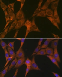 Anti-STAT4 antibody [GT1244] used in Immunocytochemistry/ Immunofluorescence (ICC/IF). GTX02841