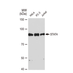 Anti-STAT4 antibody [GT1244] used in Western Blot (WB). GTX02841