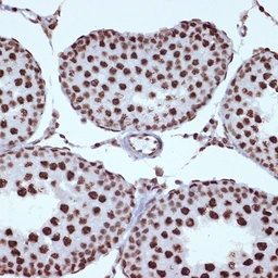 Anti-ILF3 antibody [GT1247] used in IHC (Paraffin sections) (IHC-P). GTX02844