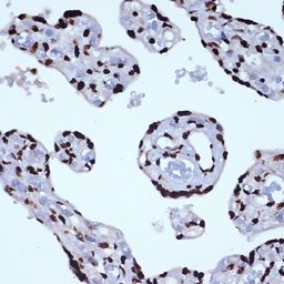 Anti-ILF3 antibody [GT1247] used in IHC (Paraffin sections) (IHC-P). GTX02844
