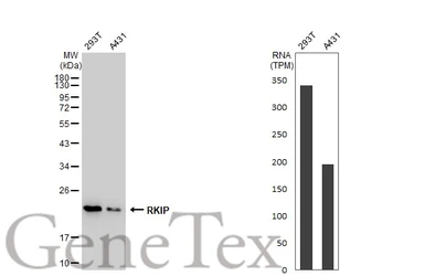 Anti-RKIP antibody [GT1249] used in Western Blot (WB). GTX02846
