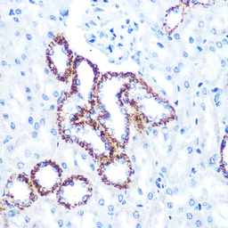Anti-C1qBP antibody [GT1250] used in IHC (Paraffin sections) (IHC-P). GTX02847