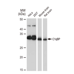 Anti-C1qBP antibody [GT1250] used in Western Blot (WB). GTX02847