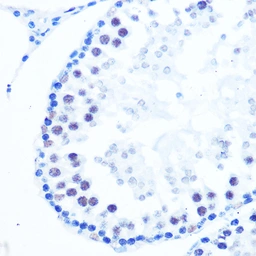 Anti-DNA polymerase beta antibody [GT1251] used in IHC (Paraffin sections) (IHC-P). GTX02848