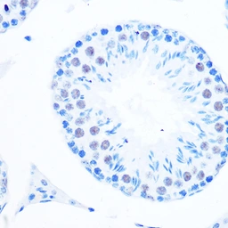 Anti-DNA polymerase beta antibody [GT1251] used in IHC (Paraffin sections) (IHC-P). GTX02848