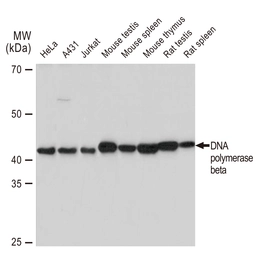 Anti-DNA polymerase beta antibody [GT1251] used in Western Blot (WB). GTX02848