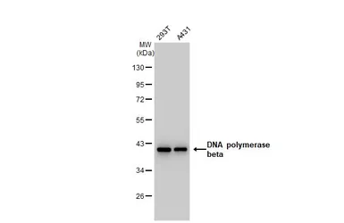 Anti-DNA polymerase beta antibody [GT1251] used in Western Blot (WB). GTX02848