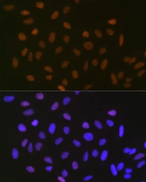 Anti-SUMO2 + SUMO3 antibody [GT1253] used in Immunocytochemistry/ Immunofluorescence (ICC/IF). GTX02850