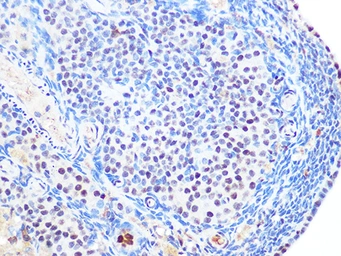 Anti-SUMO2 + SUMO3 antibody [GT1253] used in IHC (Paraffin sections) (IHC-P). GTX02850
