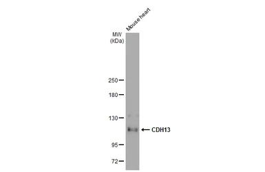 Anti-CDH13 antibody [GT1255] used in Western Blot (WB). GTX02852