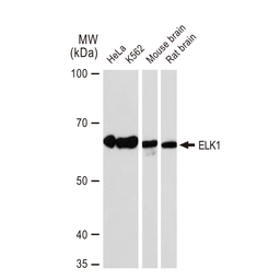 Anti-ELK1 antibody [GT1257] used in Western Blot (WB). GTX02854