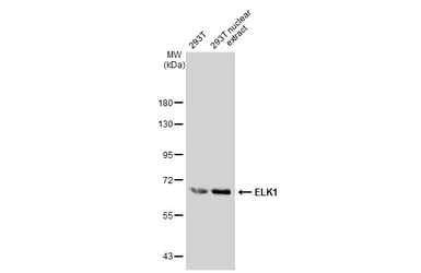 Anti-ELK1 antibody [GT1257] used in Western Blot (WB). GTX02854