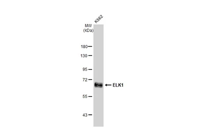 Anti-ELK1 antibody [GT1257] used in Western Blot (WB). GTX02854