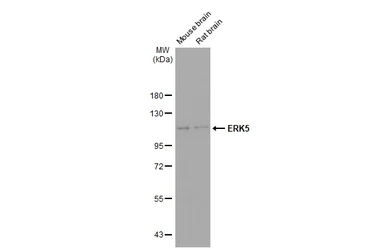 Anti-ERK5 antibody [GT1258] used in Western Blot (WB). GTX02855